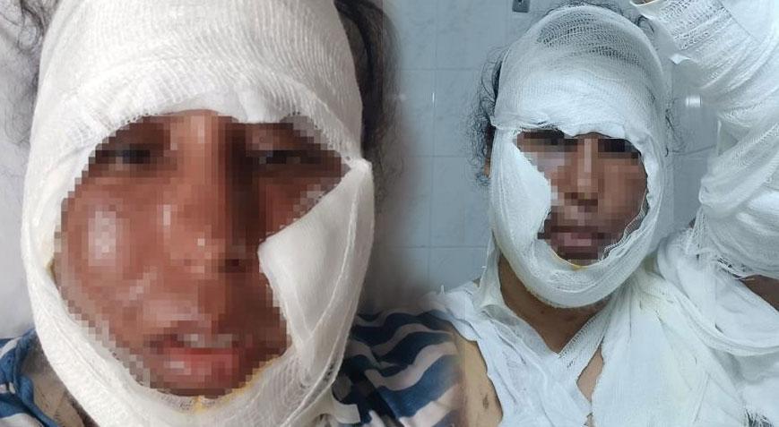 Yer: Sakarya! Görümce geline dehşeti yaşattı